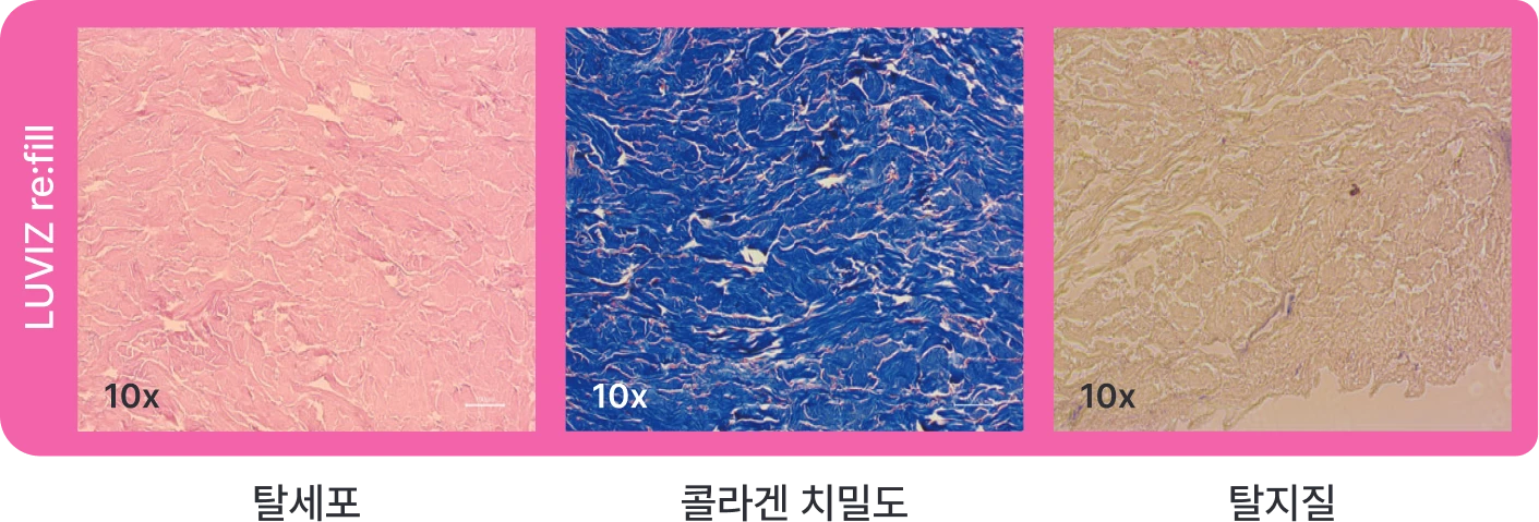 After Processing (LUVIZ re:fill)