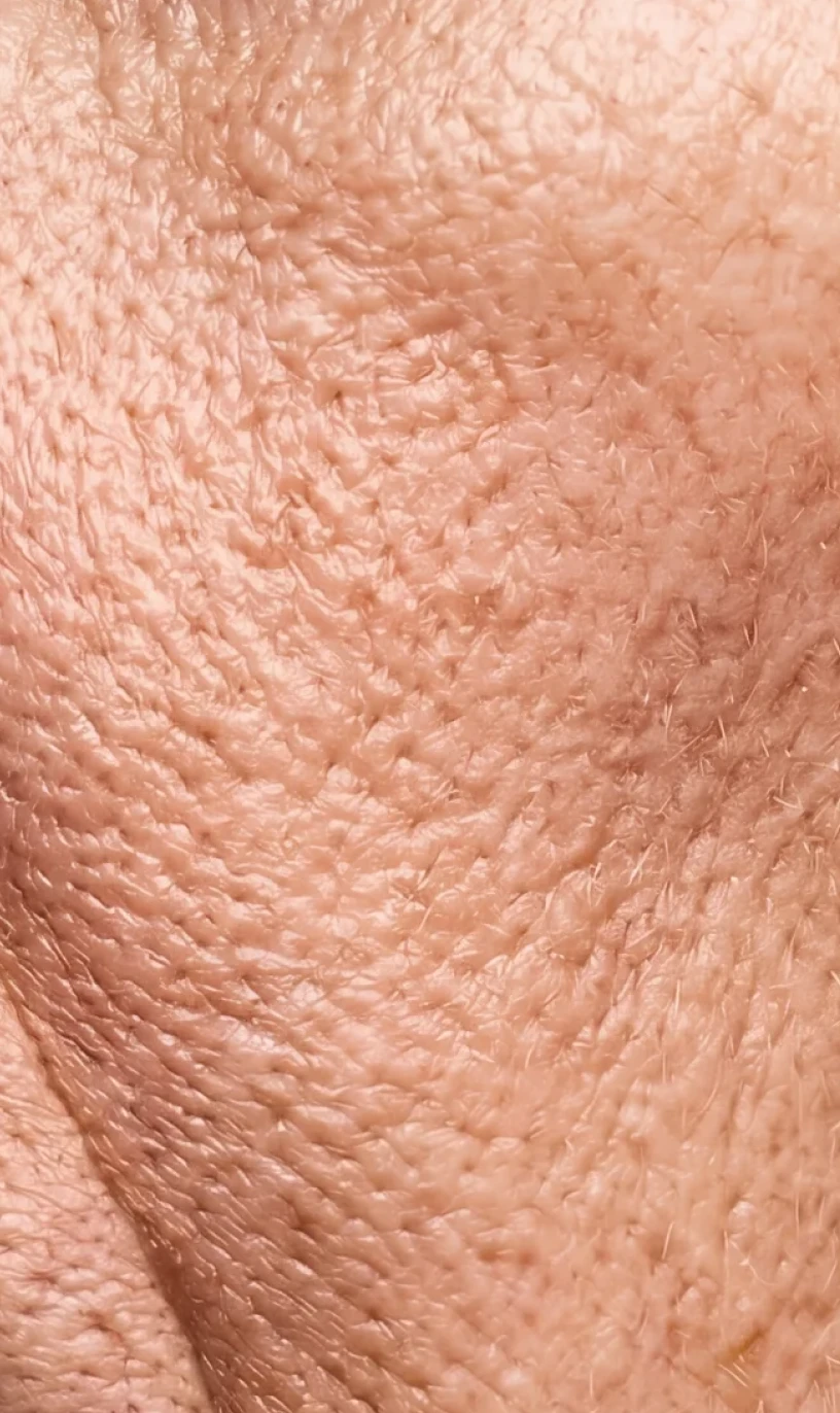 Skin Improvement