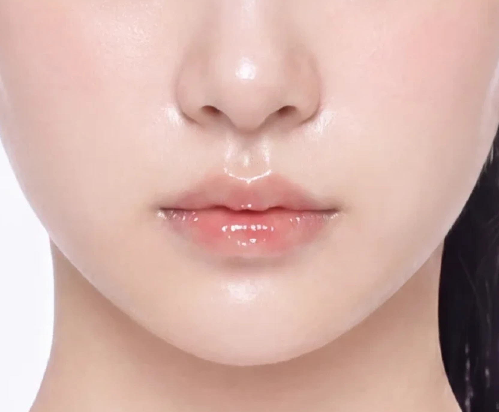 시술 4주 후
