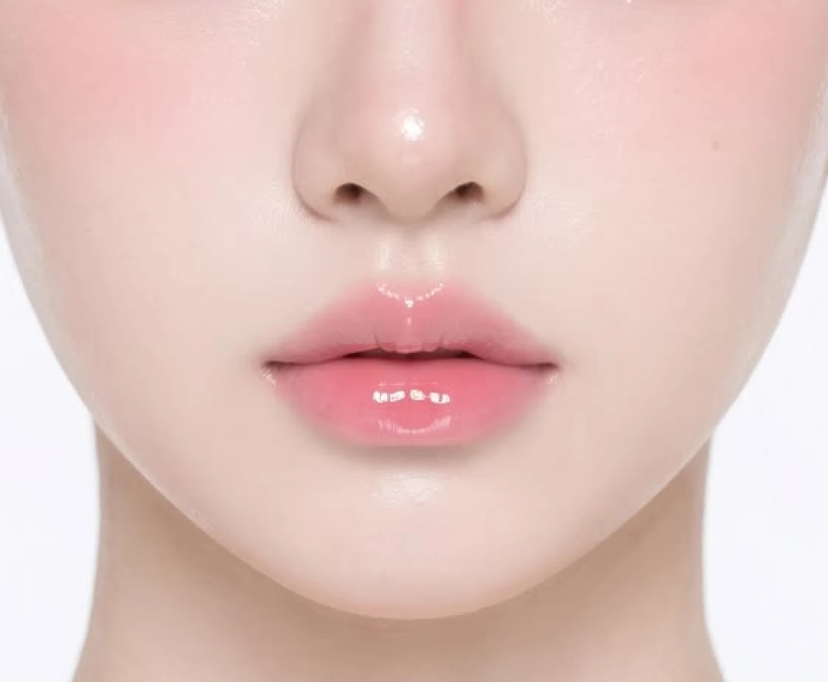 시술 2주 후