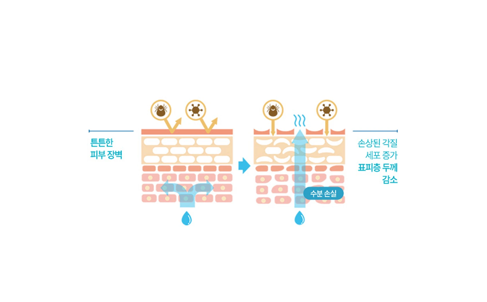 Skin changes due to decreased aquaporin-3